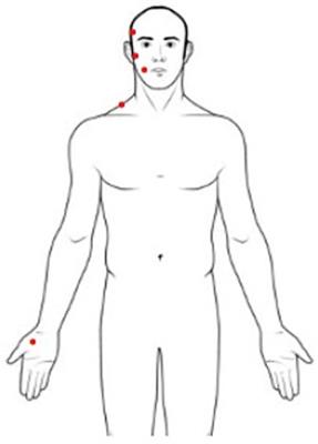 Hyperalgesia and Central Sensitization in Subjects With Chronic Orofacial Pain: Analysis of Pain Thresholds and EEG Biomarkers